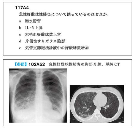 第118回国試を振り返って | 医師国家試験予備校MAC