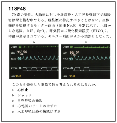 第120回国試を振り返って | 医師国家試験予備校MAC